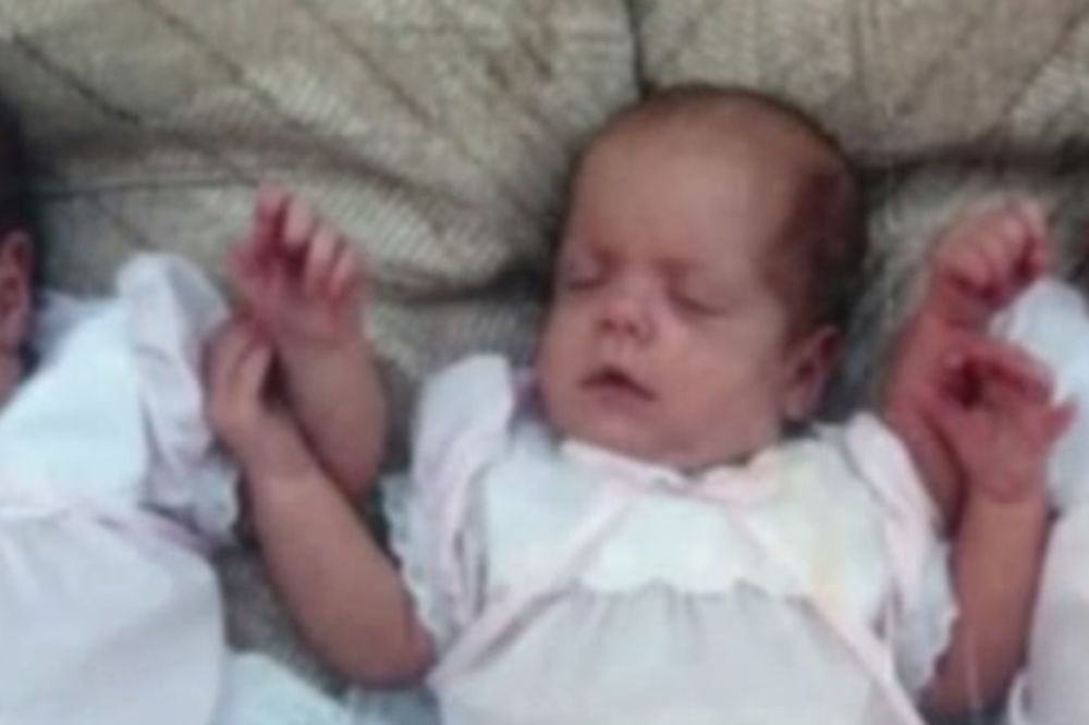 (VIDEO) Ove 3 bebe su u poslednjem času spasene iz požara, ali su ipak zadobile teške povrede
