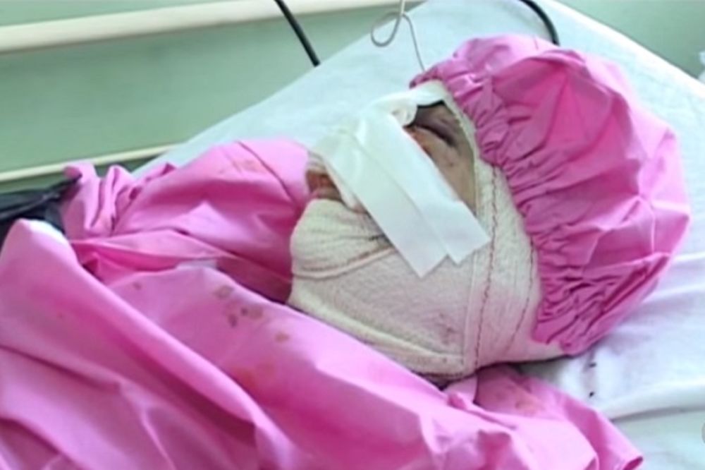 PREMA ŽENAMA GORE NEGO PREMA STOKI: Avganistanac ženi odsekao nos i otišao u talibane