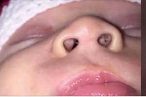 (VIDEO) Otišla je da nahrani bebu, ali je videla crne tačkice u njenom nosu. Ovo je bilo upozorenje