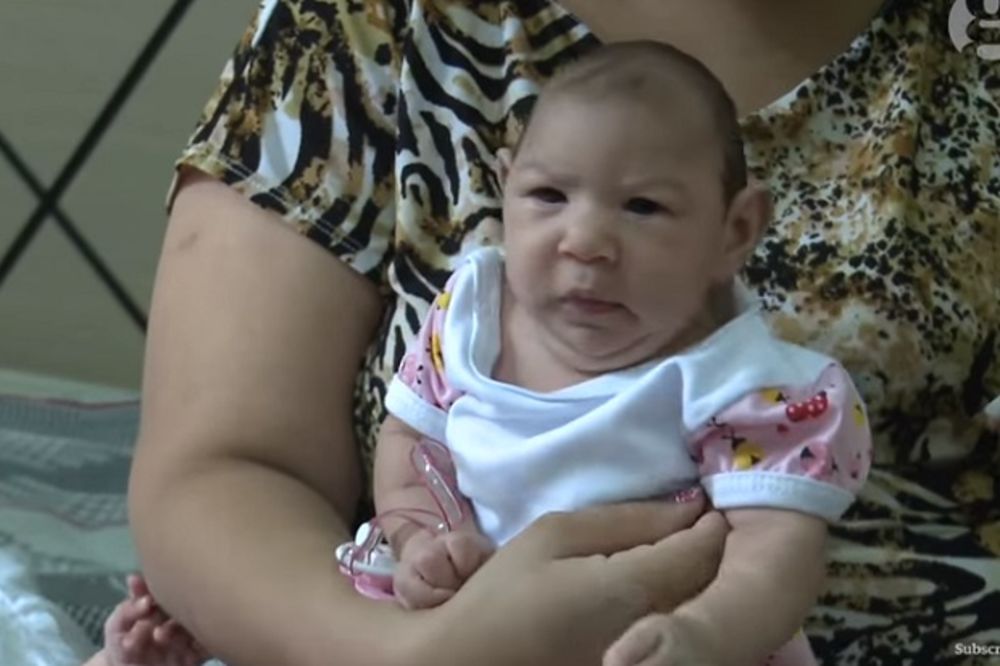 (VIDEO) NE ZNAM DA LI ĆE IKAD GOVORITI: Potresna ispovest majke čiju ćerkicu je pogodio virus zika
