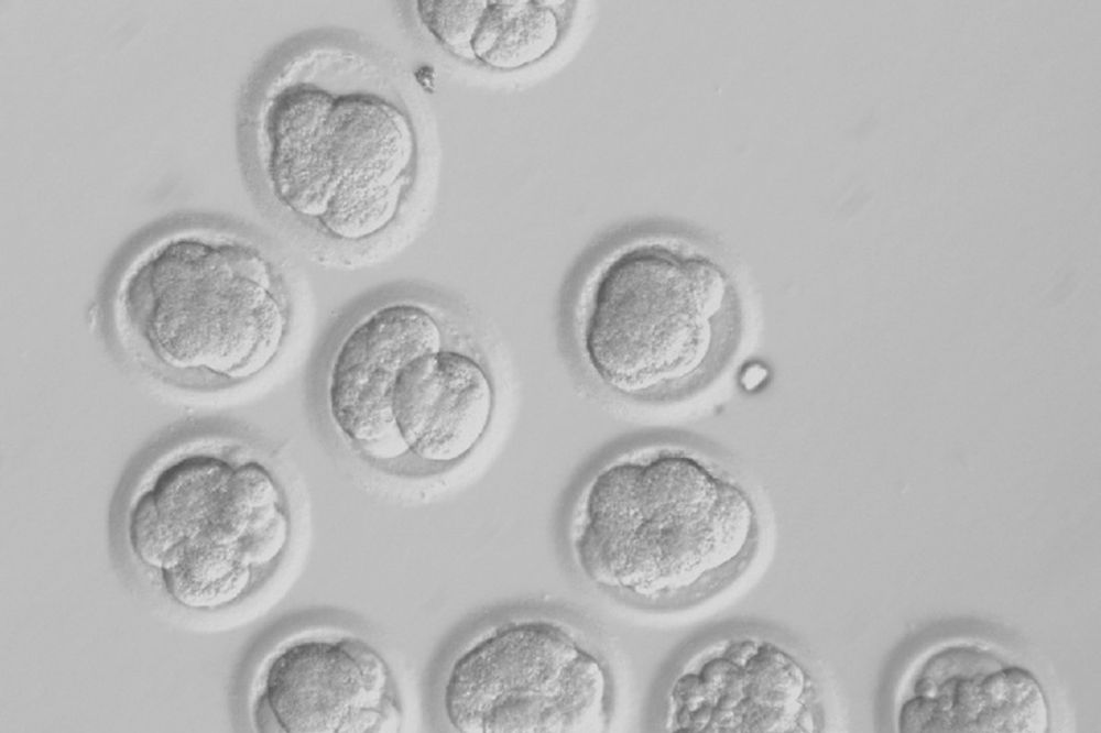 KONTROVERZNA ODLUKA BRITANACA: Po prvi put izdata dozvola za modifikaciju ljudskih embriona