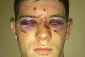 HRVATSKA POLICIJA: Srpski mladić pretučen zbog pesme, ne iz mržnje!