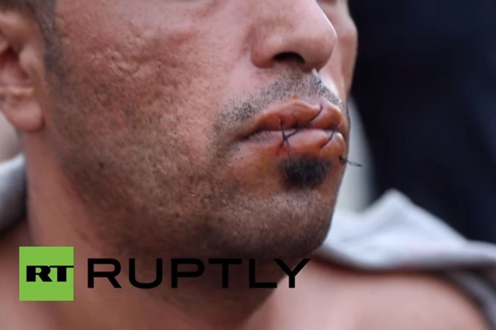 JAD I OČAJ: Iranski migranti u Kaleu zašili usta iz protesta i zovu UN da vide u čemu žive