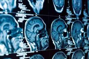 Naučnici otkrivaju: Podela na levu i desnu hemisferu mozga ne postoji?