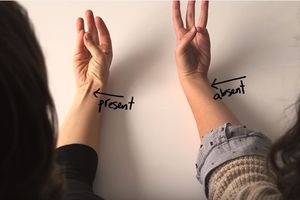(VIDEO) Većina ljudi nema ovaj mišić na ruci, a evo i zašto