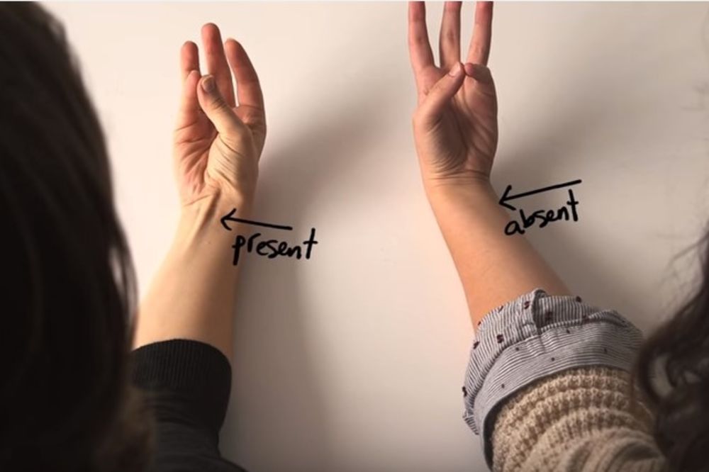 (VIDEO) Većina ljudi nema ovaj mišić na ruci, a evo i zašto