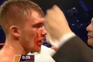 (VIDEO) BORI SE ZA ŽIVOT: Britanski bokser u veštačkoj komi zbog krvarenja na mozgu