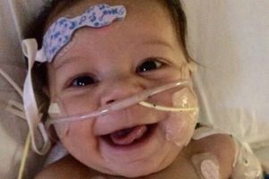 (FOTO) Ova beba umrla je na operacionom stolu, ali 7 dana kasnije...