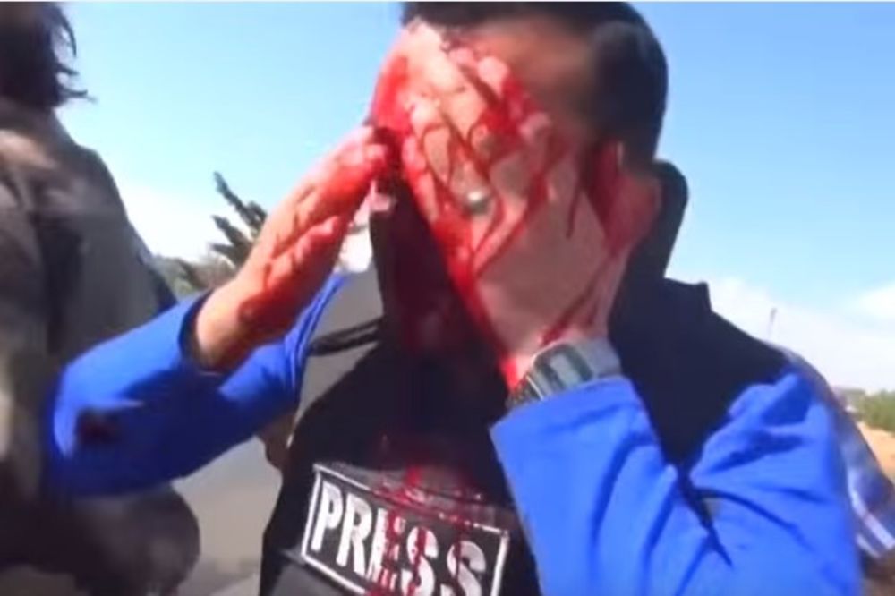 (UZNEMIRUJUĆI VIDEO) RANJEN U ALEPU: Novinara pogodio šrapnel u lice dok je izveštavao iz Sirije!