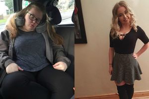 (FOTO) Tinejdžerka je smršala 45 kilograma zahvaljujući samo jednom triku!
