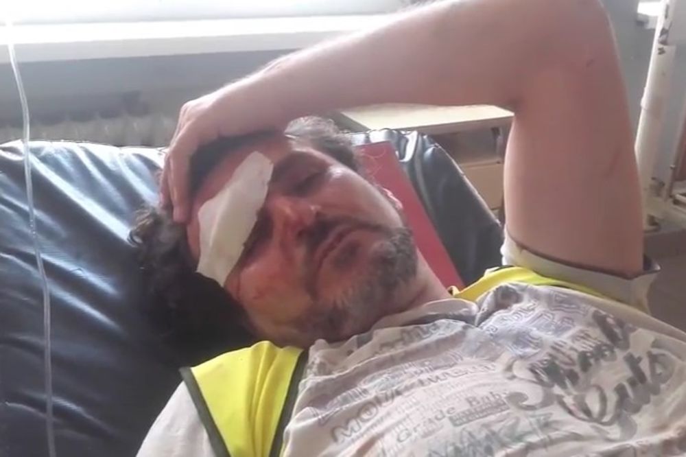 (VIDEO) UDES U GRDELIČKOJ KLISURI: Povređenim radnicima pomagali očevici nesreće