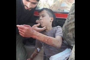 UŽAS U SIRIJI: Umerena opozicija odsekla glavu dečaku