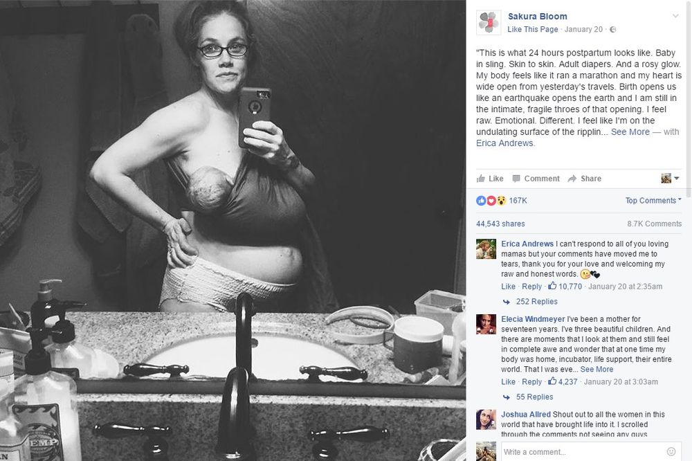 (FOTO) HRABRA MAJKA: Pogledajte kako zaista izgleda žensko telo 24 sata nakon porođaja