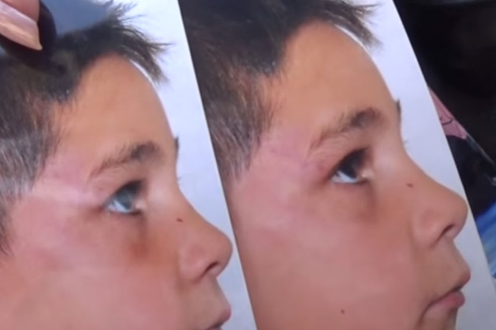 (VIDEO) LEKARI ŠAMARALI I DAVILI DEČAKA (7): Nečuveni skandal u makedonskoj bolnici!