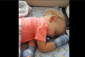 (FOTO) DRAMA U ZAGREBAČKOM PARKU: Bebi vreli šaht spržio ručice, dete noćima ne spava od bolova!