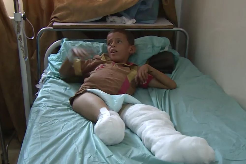 (VIDEO) DA TI SRCE ISKOČI OD TUGE: Mali Sirijac rođen je gluv i nem, a bomba mu je odnela i nogu