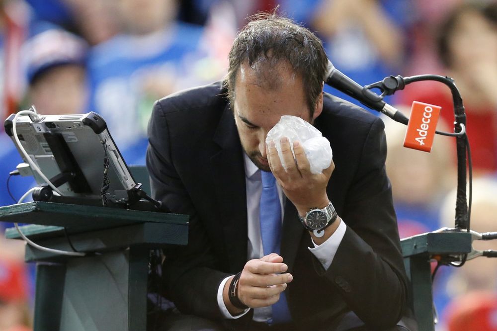 (VIDEO) MORAO POD NOŽ: Operisan teniski sudija kojeg je igrač brutalno pogodio lopticom u oko