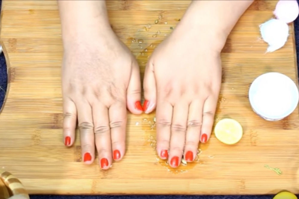 Žena otkrila čudesan recept: Kako da skinete staračke mrlje i fleke sa ruku! (VIDEO)