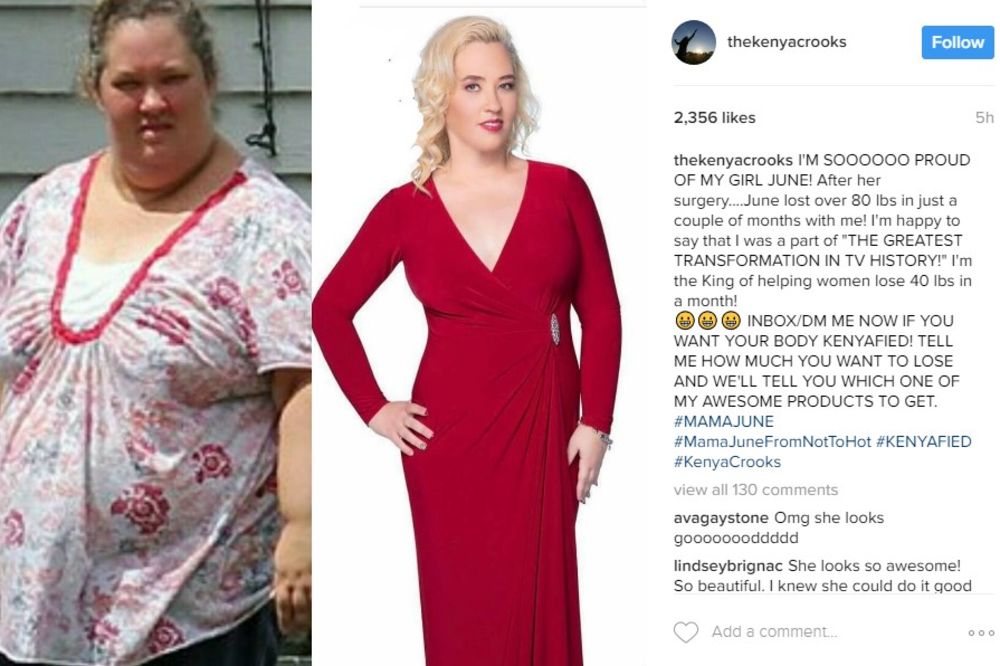 VIDEO MAMA DŽUN SE HRANILA ŠPAGETAMA SA MARGARINOM: Sada je smršala 136 kilograma i izgleda BRUTALNO
