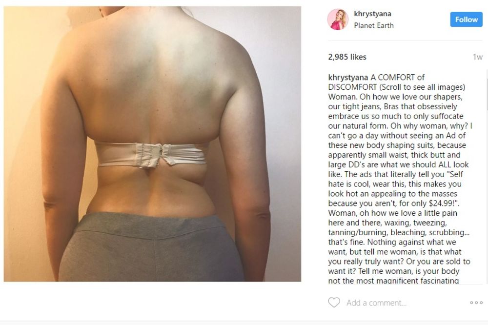 (FOTO) BRUTALNA ISTINA JEDNE MANEKENKE: Evo šta se desilo njenom telu od nošenja USKE GARDEROBE!