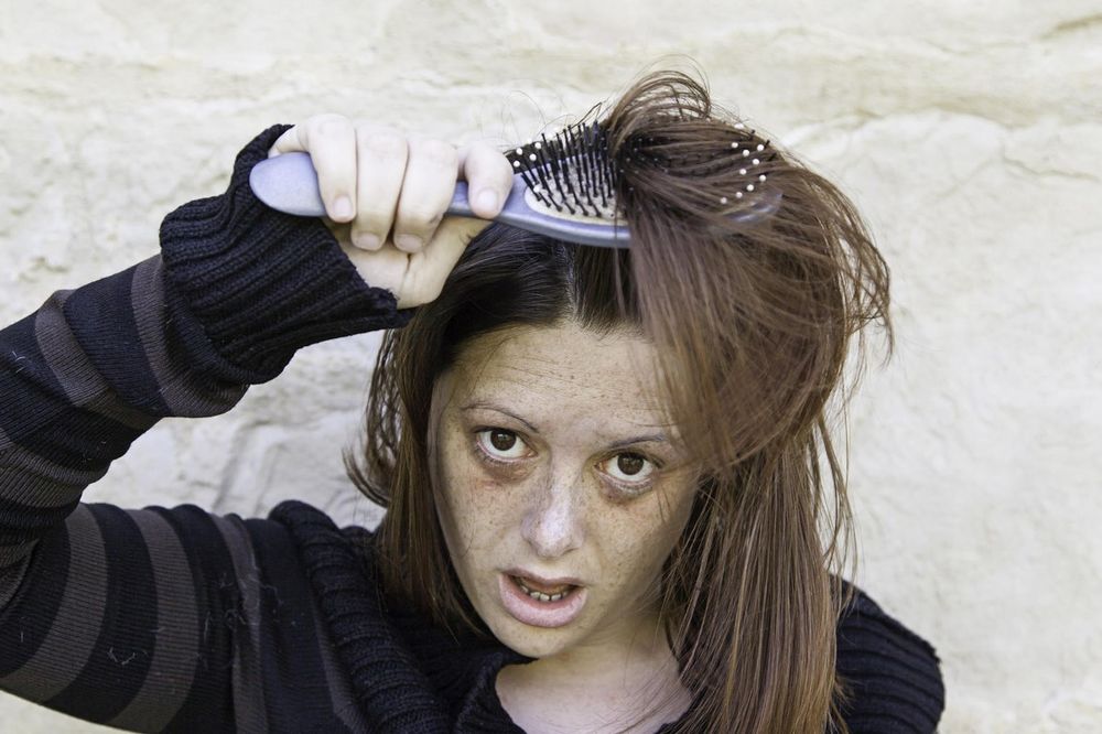AKO VAM OPADA VIŠE NEGO INAČE: 5 znakova na kosi koji otkrivaju zdravstvene probleme