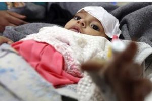 (VIDEO) UŽAS U JEMENU: Od kolere umrlo 1.700, a zaraženo 300.000 ljudi!