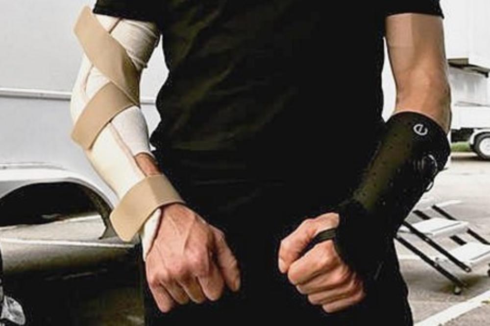 (FOTO) POVREDA NA SNIMANJU FILMA: Holivudski glumac slomio obe ruke!