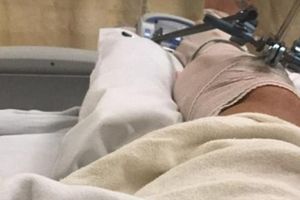 (FOTO) HOLIVUDSKI GLUMAC ZABRINUO FANOVE: Slomio nogu u bizarnoj nesreći