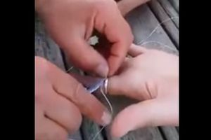 (VIDEO) DOKTORI NISU MOGLI DA JOJ POMOGNU: Ženi se prsten zaglavio na prstu, a skinula ga je na genijalan način!