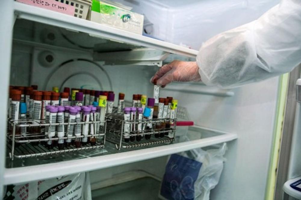SVETSKI DAN BORBE PROTIV OPAKE BOLESTI: U Srbiji sve više zaraženih hepatitisom C