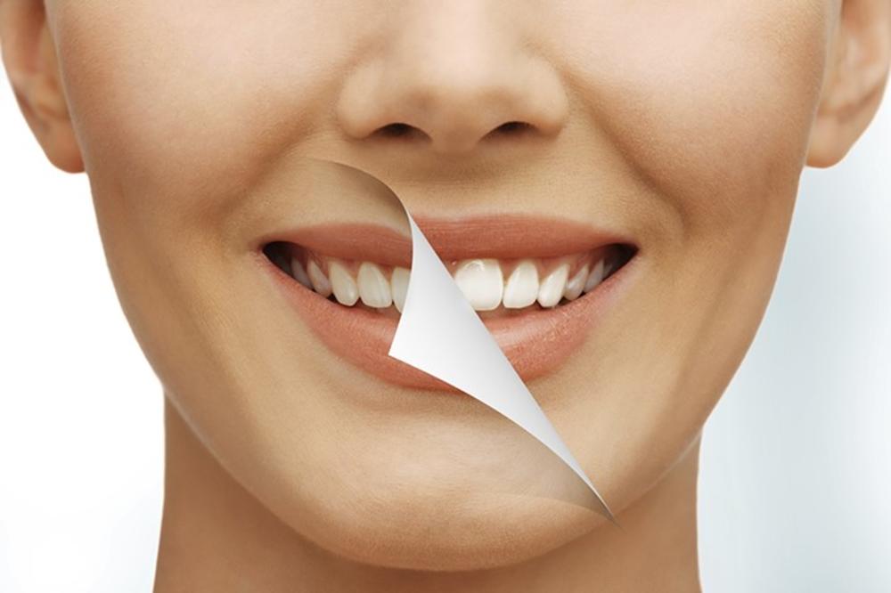 OSMEH FILMSKE DIVE: Kako da sami i bez hemikalija izbelite zube!