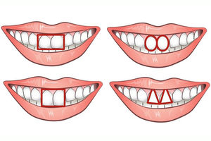 (FOTO) Šta oblik vaših zuba otkriva o vašem karakteru?