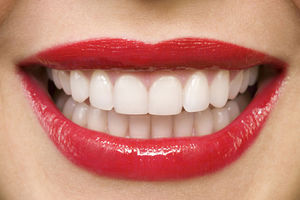 Kako da sami izbelite zube i do čak 5 nijansi?