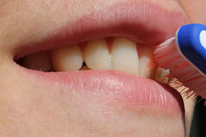 Soda bikarbona i limun štete zubima! Nikad ne biste pogodili šta ih izbeljuje! (FOTO) (GIF)