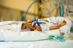 MALI PAVLE NIJE IZDRŽAO: Uprkos naporima lekara, beba koju je pretukao očuh preminula