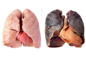 CIGARETE ZAISTA UBIJAJU: Ovako stvarno izgledaju pluća pušača!