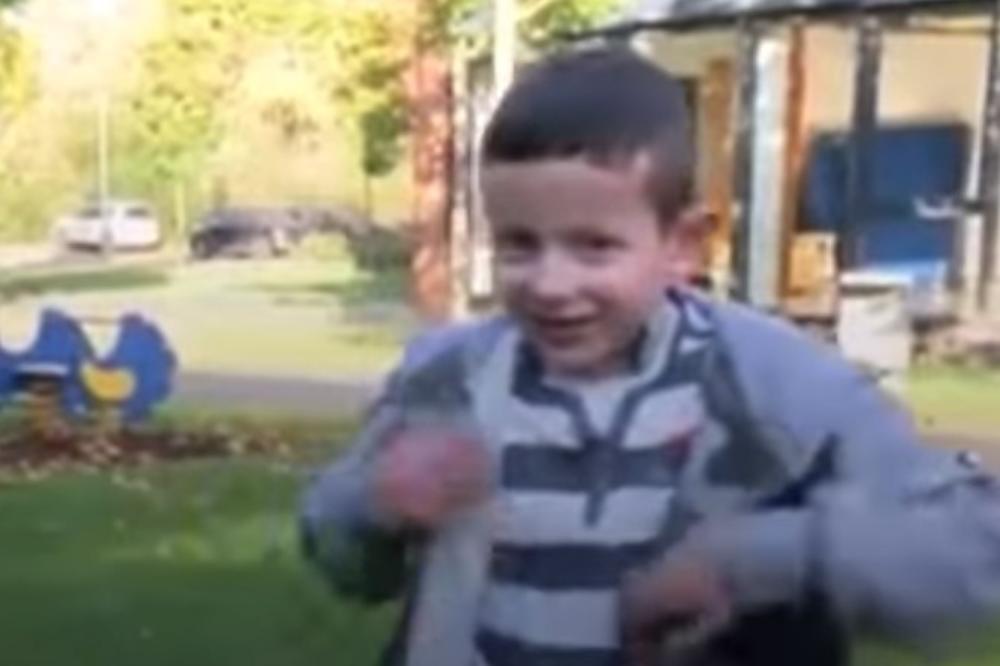 (VIDEO) IMA NADE ZA GALU I DESPOTA, SRPSKU DECU-LEPTIRE: Mali Hasan u Nemačkoj dobio potpuno novu kožu, mogu li ovako da se izleče i naša deca?