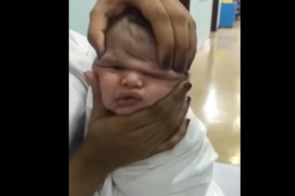(VIDEO) ŠOKANTAN SNIMAK MUČENJA NOVOROĐENČETA: Medicinska sestra stiskala bebinu glavu, a druge dve snimale i smejale se!