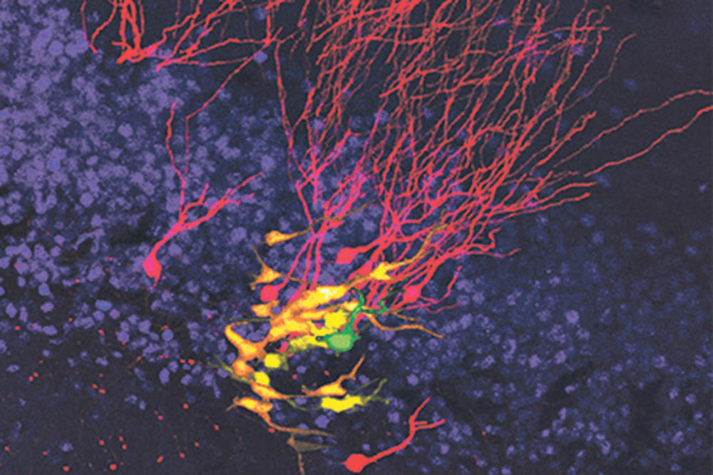 VELIKI USPEH ISTRAŽIVAČA: Snimili rađanje nervnih ćelija!