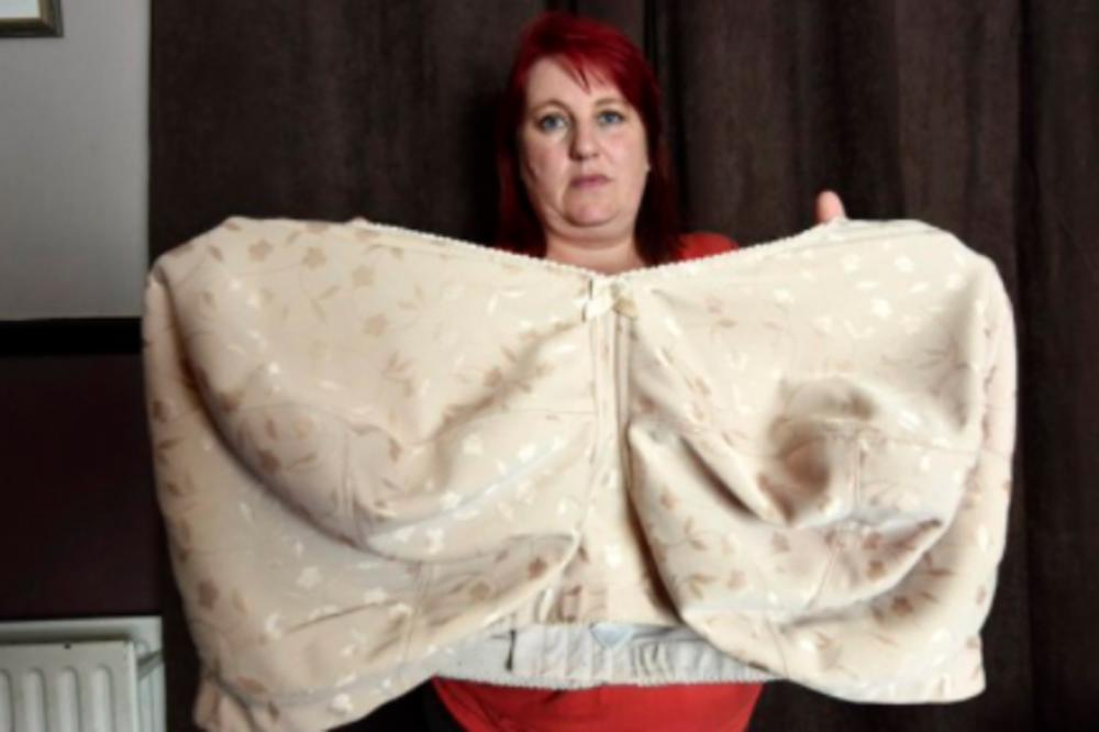 (FOTO) NOSI BRUSHALTER VELIČINE 40M: Grudi su joj teške 19 kilograma! Ovo je njena ISPOVEST!