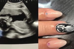 (FOTO) SLIKA PODELJENA VIŠE OD 145.00 PUTA: Oslikala je nokat ultrazvukom buduće mame, a razlog će vas IMPRESIONIRATI!