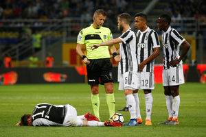 (UZNEMIRUJUĆE FOTOGRAFIJE) HOROR POVREDA HRVATSKOG FUDBALERA: Mario Mandžukić pokazao stravičnu povredu koju je zadobio u velikom italijanskom derbiju!