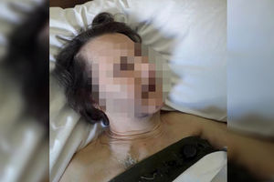 SKANDAL NA VMA: Bolničar ispustio teško bolesnu ženu, pa NOKAUTIRAO njenog sina! (KURIR TV)