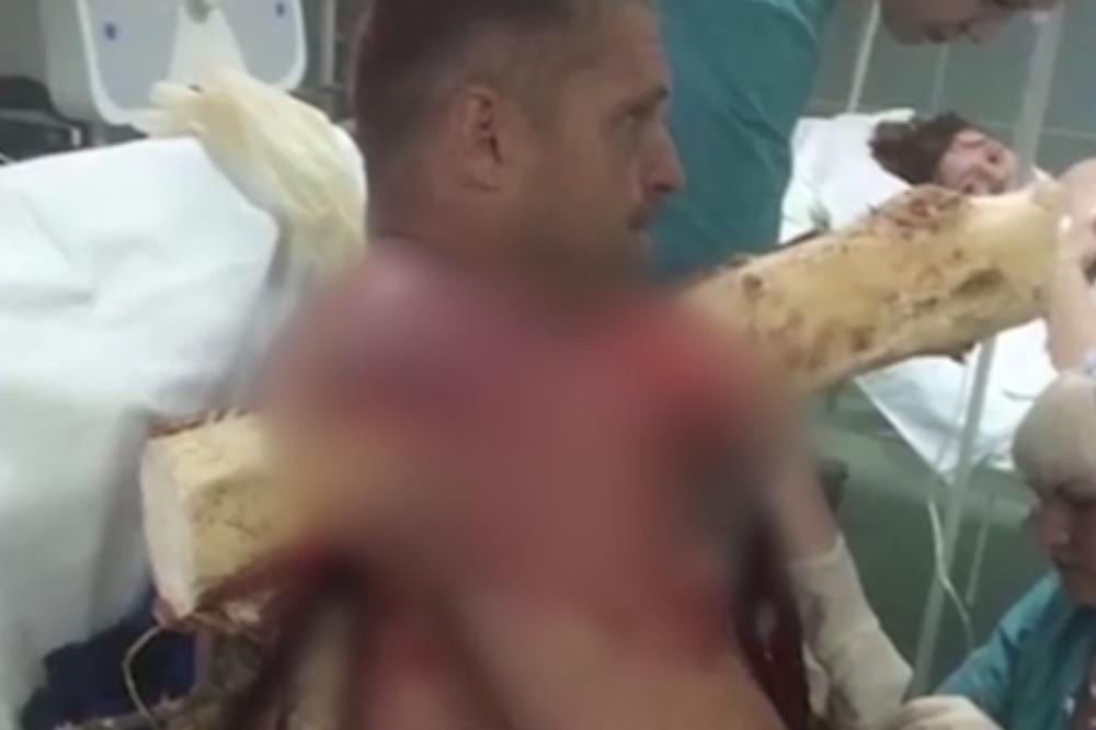 BELORUSA STREFIO DOSAD NEVIĐENI UŽAS: U rame mu se zabilo CELO STABLO, a on pravio selfije po bolnici, kao da ništa nije bilo (VIDEO)