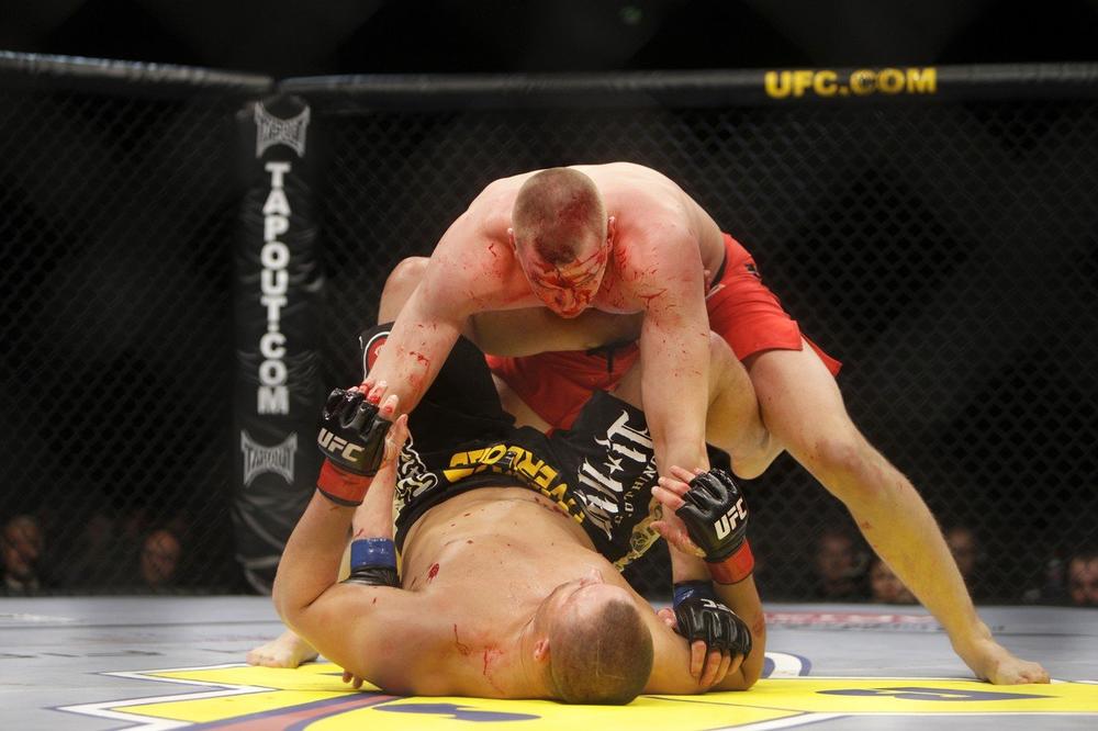 PREVRNUĆE VAM SE ŽELUDAC! UFC borac dobio jezive batine! Protivnik mu bukvalno RASCEPAO facu! (UZNEMIRUJUĆI FOTO)