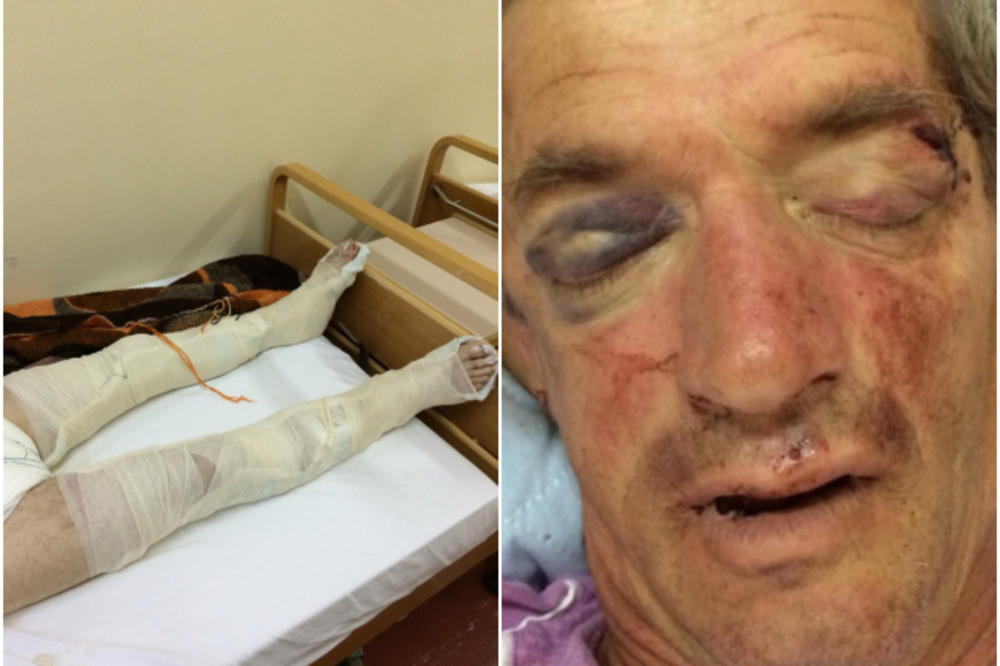 UŽAS U BANJALUCI: Penzioneru metalnim šipkama polomili obe noge, brutalno ga pretukli na kućnom pragu