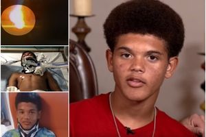 KAMERE SNIMILE KADA JE DEČAKA (13) UDARIO GROM: Probudio se posle 3 dana, a ovom mladom Amerikancu je život spasla jedna neobična stvar (VIDEO)