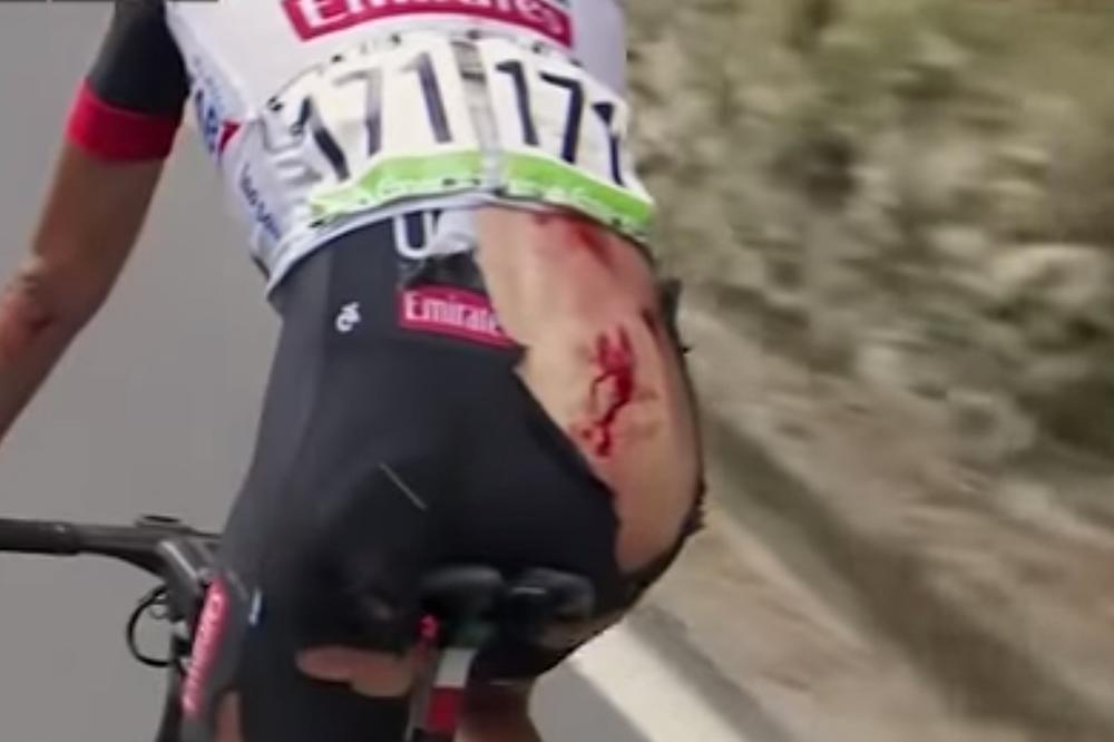 SAV KRVAV I ODERANE ZADNJICE: Herojski podvig bicikliste koga ni jeziva povreda nije sprečila da završi trku! (VIDEO)