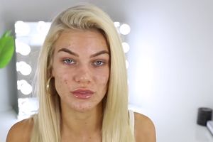 NJENO LICE JE PUNO OŽILJAKA I BUBULJICA: Blogerka OTKRILA kako izgleda PRE i POSLE šminke! (VIDEO)