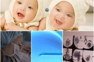 JEZIVI GENETSKI INŽENJERING UZDRMAO SVET: Kineski naučnik stvorio prve GMO bebe, svi skočili na njega! (VIDEO)